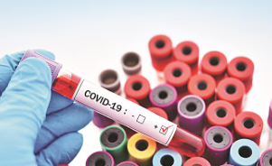 ବିହାରରେ ମଧ୍ୟ କରୋନା ଚିହ୍ନଟ ହୋଇଛି, ପାଟନା ଏମ୍ସରେ ଡାକ୍ତର ଏବଂ ନର୍ସ ସମେତ ୬ ଜଣ ସଂକ୍ରମିତ