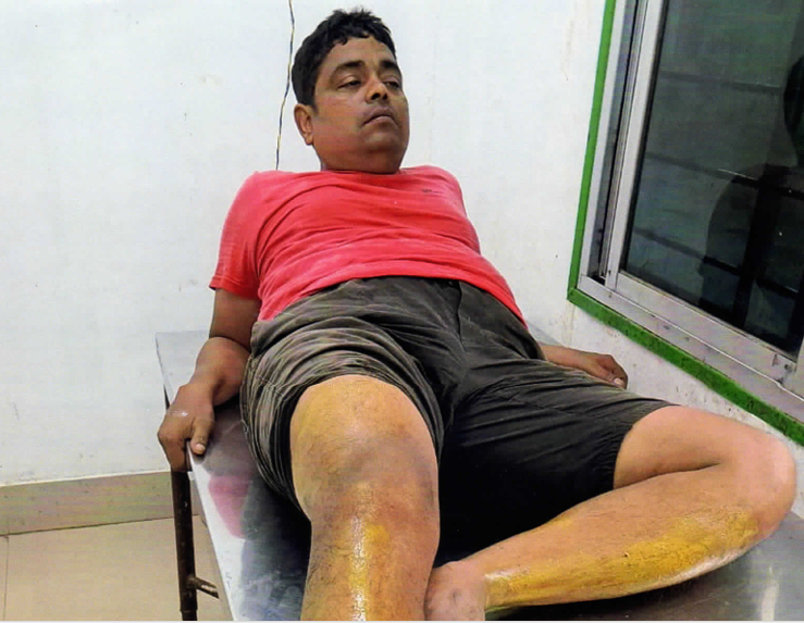 ଜମିଜମା ବିବାଦରେ ହାଇକୋର୍ଟ ଅଧିବକ୍ତାଙ୍କୁ ମରଣାନ୍ତକ ଆକ୍ରମଣ